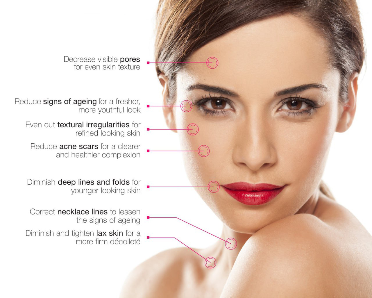 Microneedling with Radiofrequency - Lose Weight Gain Beauty!